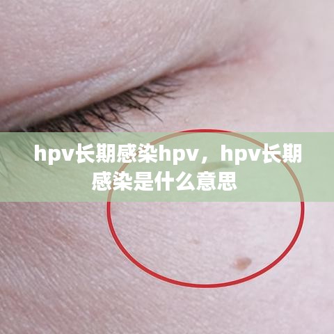 hpv长期感染hpv，hpv长期感染是什么意思 