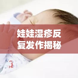 娃娃湿疹反复发作揭秘，原因、对策及日常护理全攻略