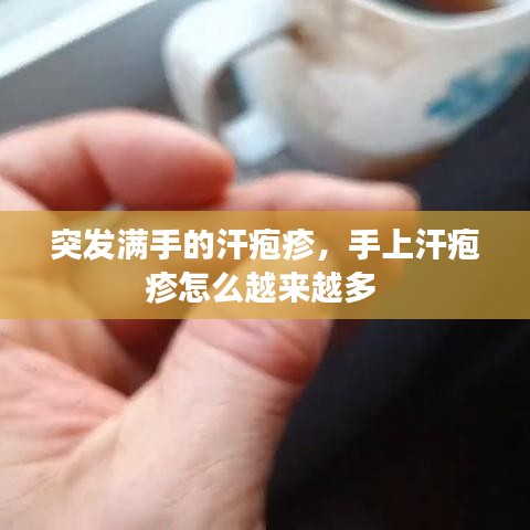 突发满手的汗疱疹，手上汗疱疹怎么越来越多 