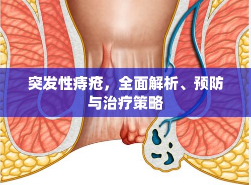 突发性痔疮，全面解析、预防与治疗策略